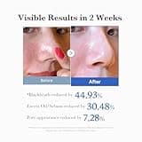 Medicube Zero Pore Pads 2.0, Dual-Textured Facial Toner Pads for Exfoliation and Pore Care with 4.5% AHA Lactic Acid & 0.45% BHA Salicylic Acid, Ideal for All Skin Types, Korean Skin Care (70 units)